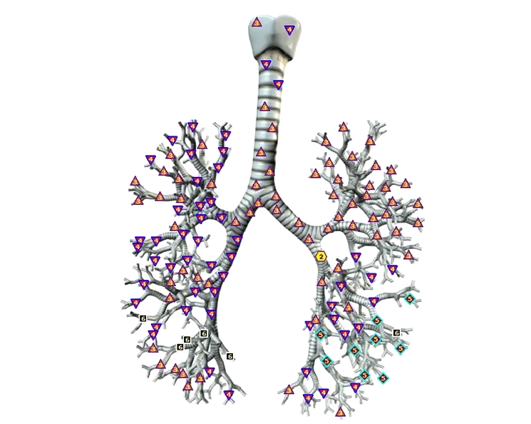 Lung and bronchial bioreceptor illustration