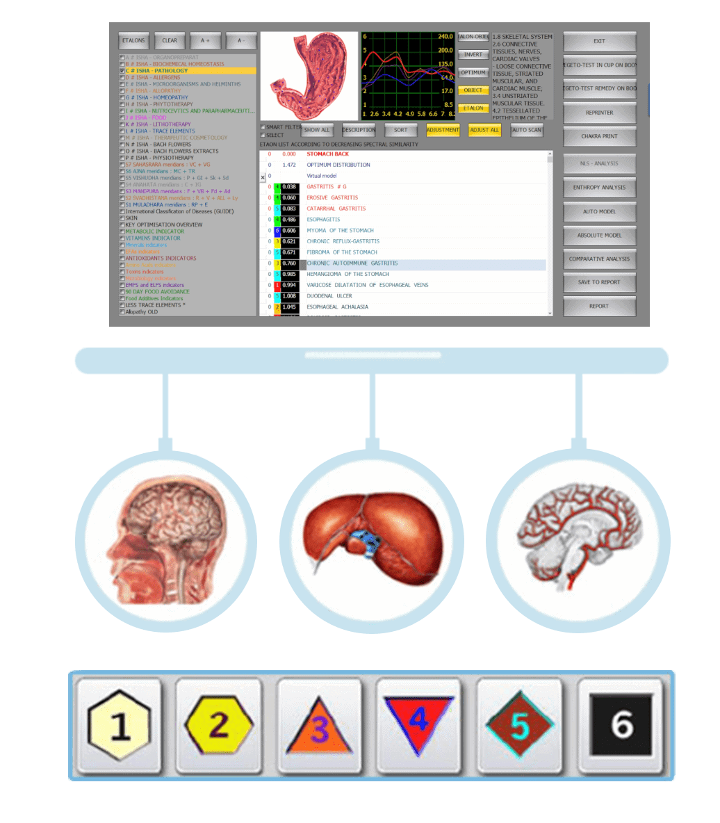 NLS analysis